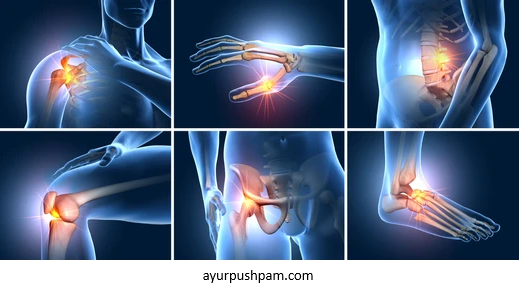 Chronic Joint Disorders